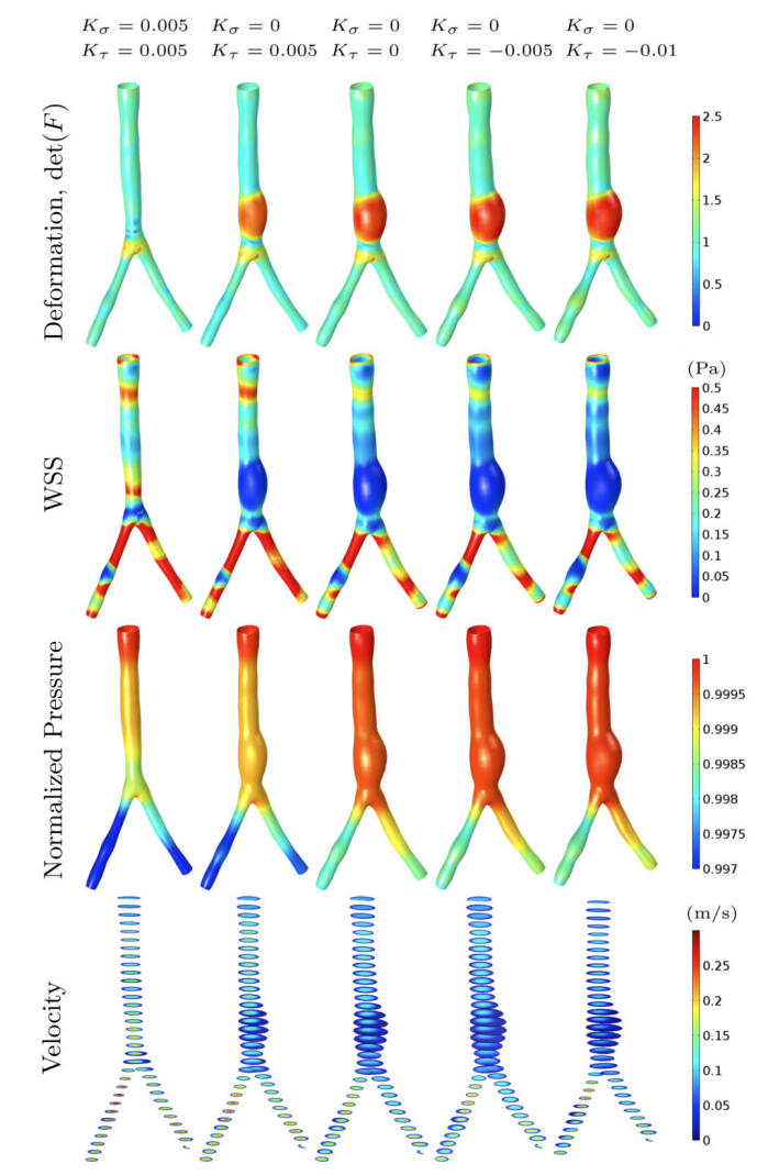 Aneurysm prediction